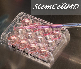 Stem Cell MD